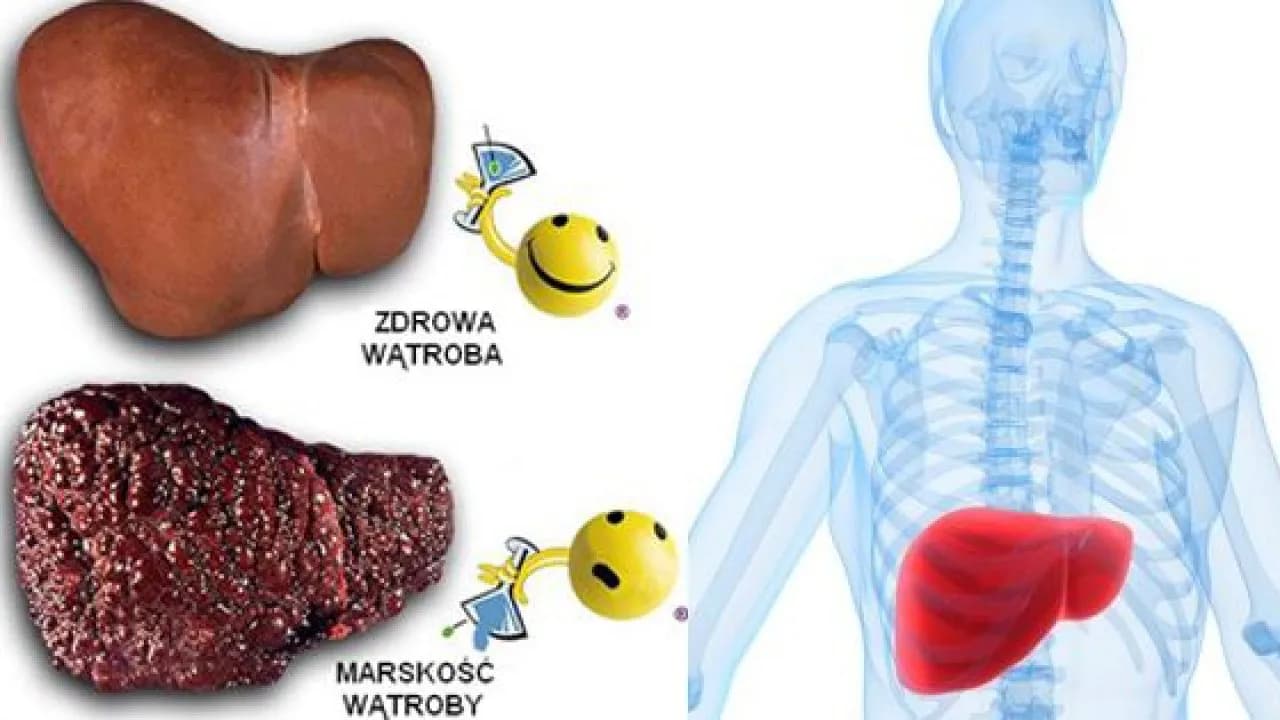 Czy wątróbka jest zdrowa? Poznaj jej korzyści i zagrożenia zdrowotne
